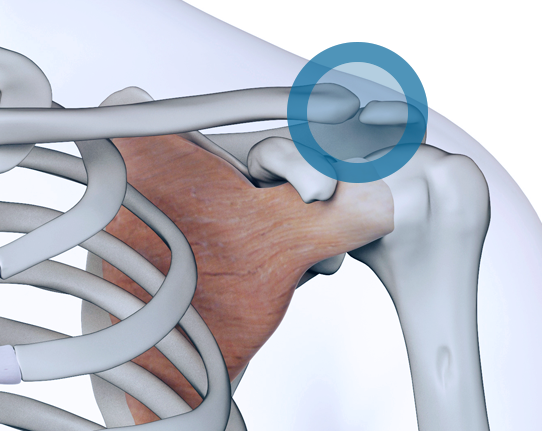 acromioclavicular